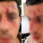 Golders Green Assault