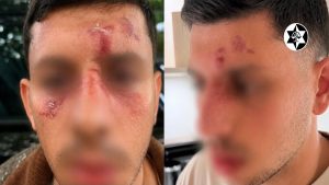 Golders Green Assault
